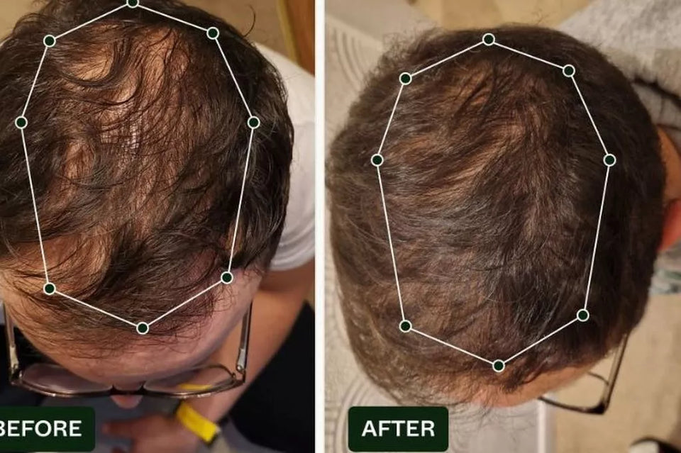 Nuevo Serum Rutina Capilar Milagrosa para hombre y mujer (45 días)
