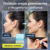 Nuevo Corrector de Orejas Estético