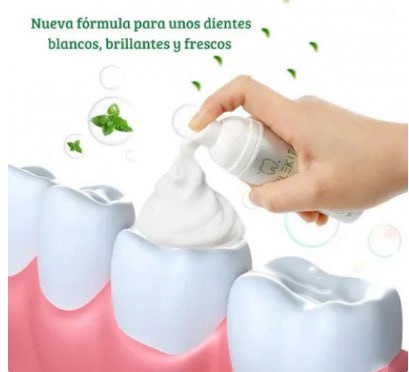 Espuma blanqueadora SmileKit