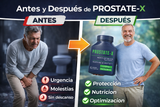 Nuevo ProstateX Cuidado Prostático Natural
