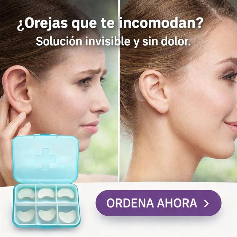 Nuevo Corrector de Orejas Estético