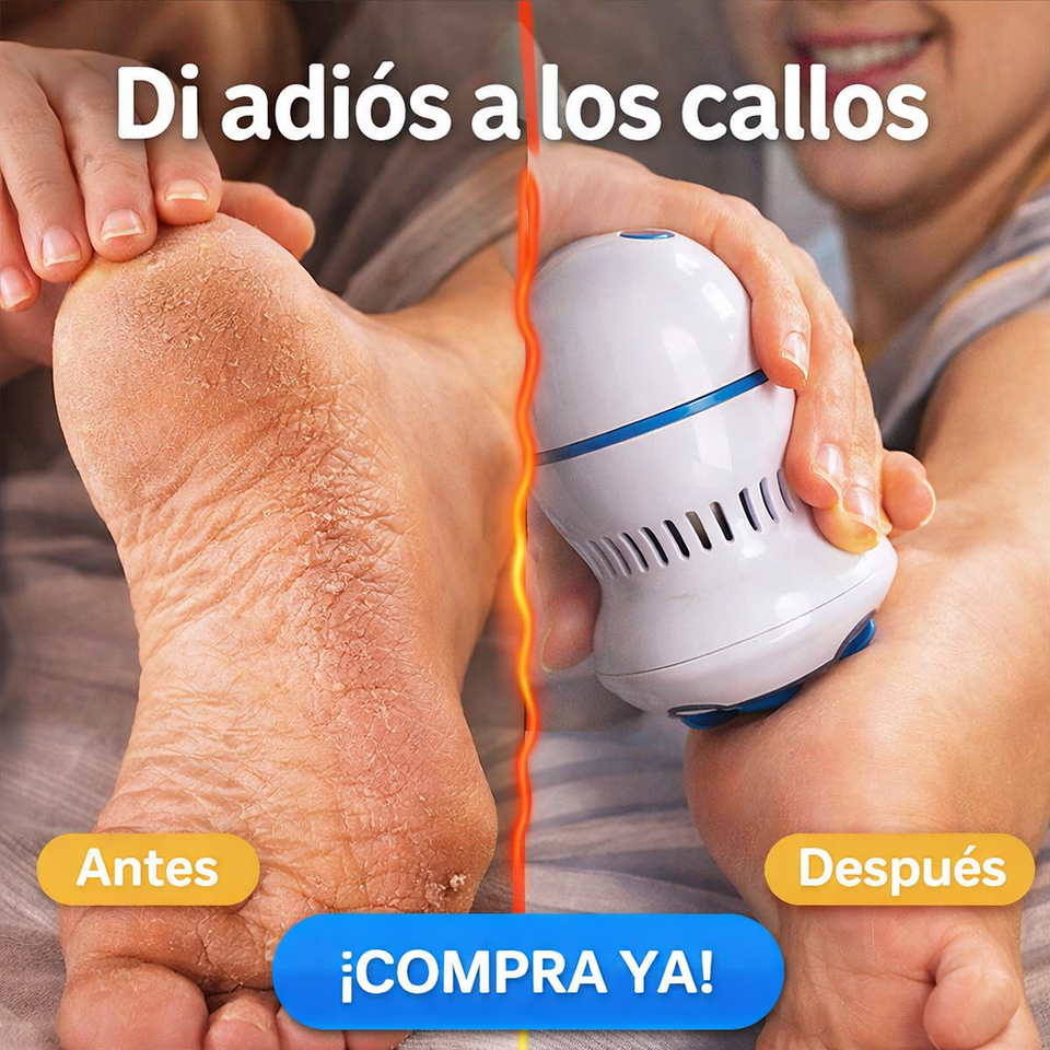 Máquina Removedora de Callos