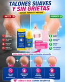 Nuevo Crema de Urea para Pies Rugosos + Calcetines