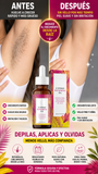 Nuevo Aceite Cyperus Inhibidor de Vello