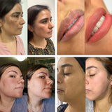 Nueva Crema Bioaqua Aclarante
