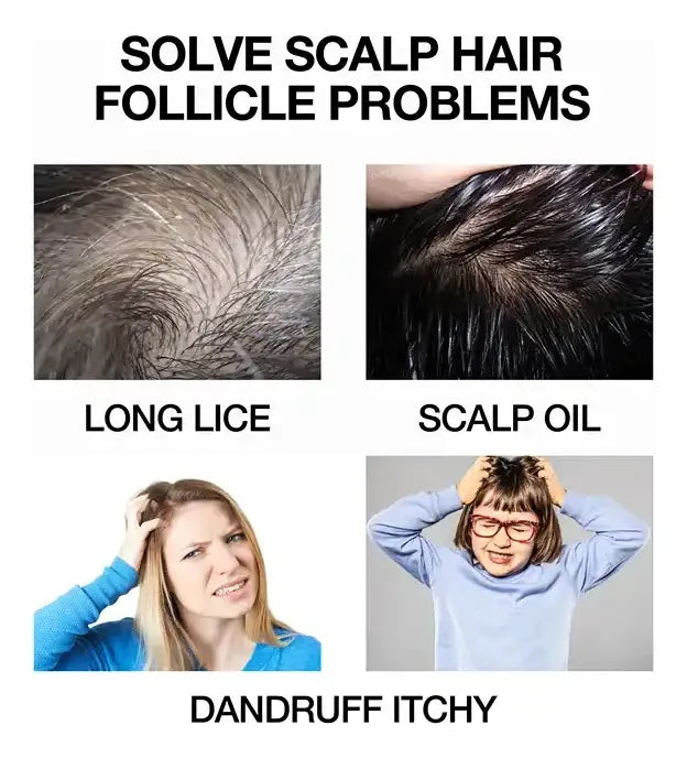 LICE REPELLENT – REPELENTE DE PIOJOS