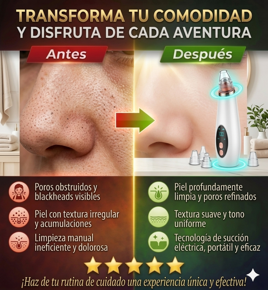 Nuevo Extractor Facial Poro Pro Compacto