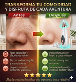 Nuevo Extractor Facial Poro Pro Compacto