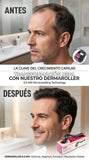 Nuevo Rodillo de Microagujas para Crecimiento de Barba