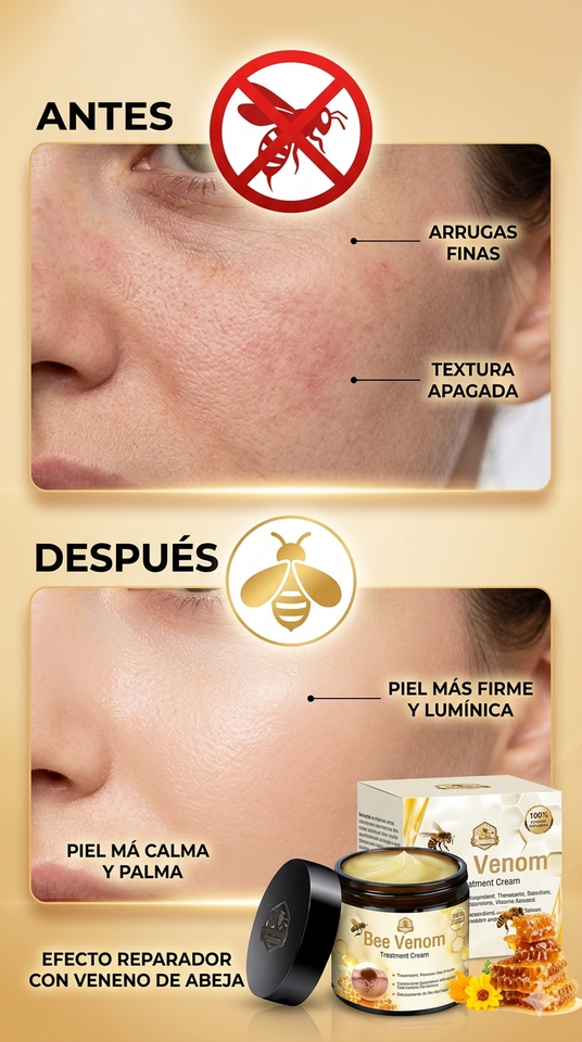Nuevo Crema Veneno de Abeja Activa