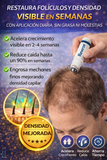 Nuevo Serum Reverse Para Crecimiento Capilar