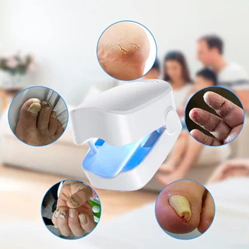 Nueva CuraLáser: Uñas Fuertes y Saludables