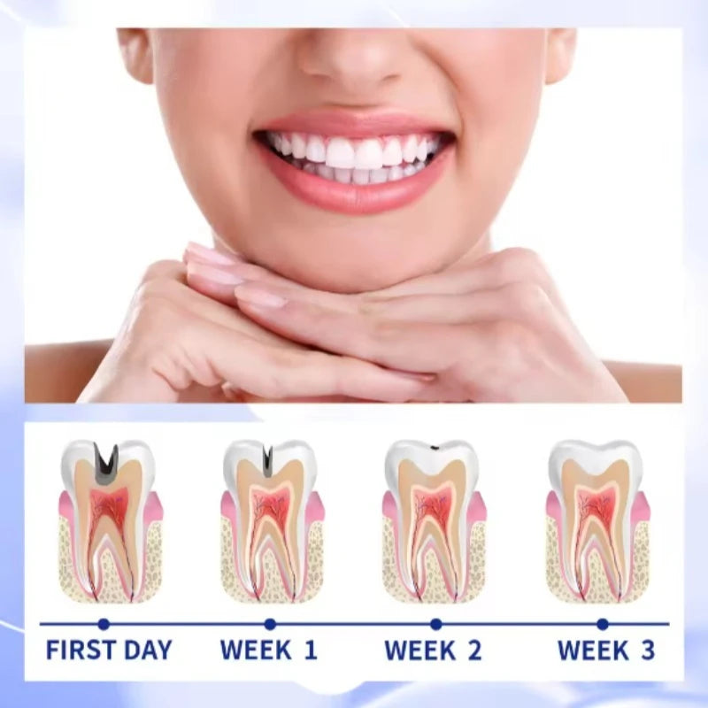 Nueva Pluma Blanqueador Dental Instantáneo