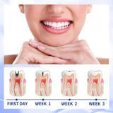 Nueva Pluma Blanqueador Dental Instantáneo