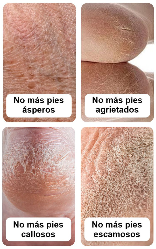 Pies Suaves Crema Hidratante Intensiva