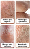 Pies Suaves Crema Hidratante Intensiva