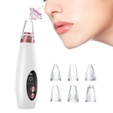 Nuevo Extractor Facial Poro Pro Compacto