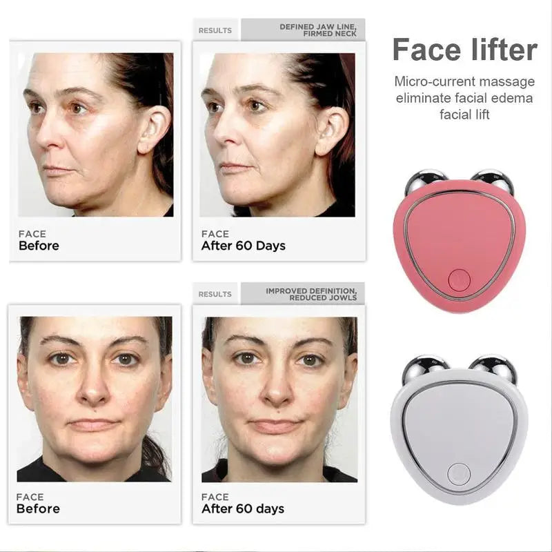 Nuevo Rodillo Facial Eléctrico Reafirma Piel