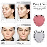 Nuevo Rodillo Facial Eléctrico Reafirma Piel