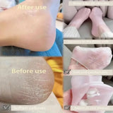 Nuevo Calcetines Hidratantes de Silicona para Pies